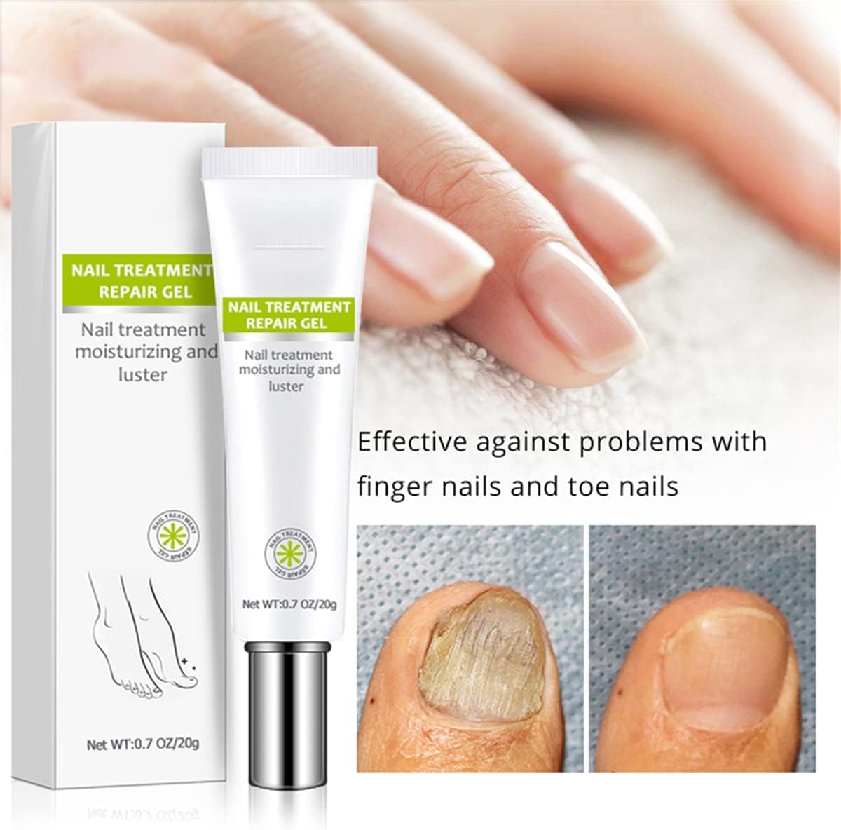 2 Pcs Nail Repair Gel