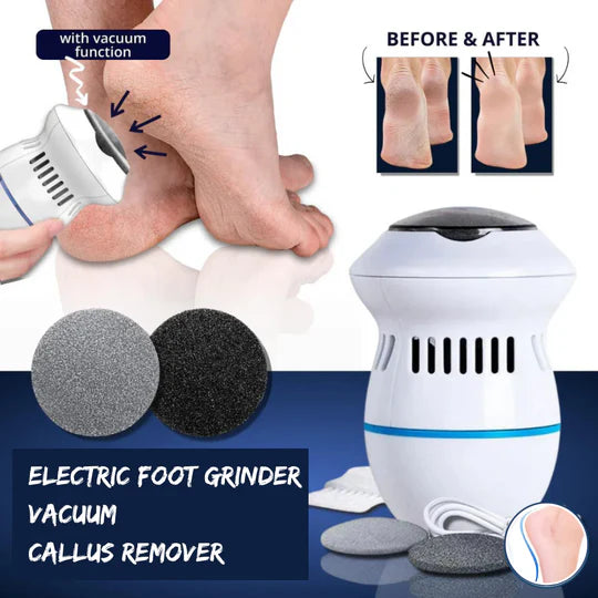 Electric Foot Grinder