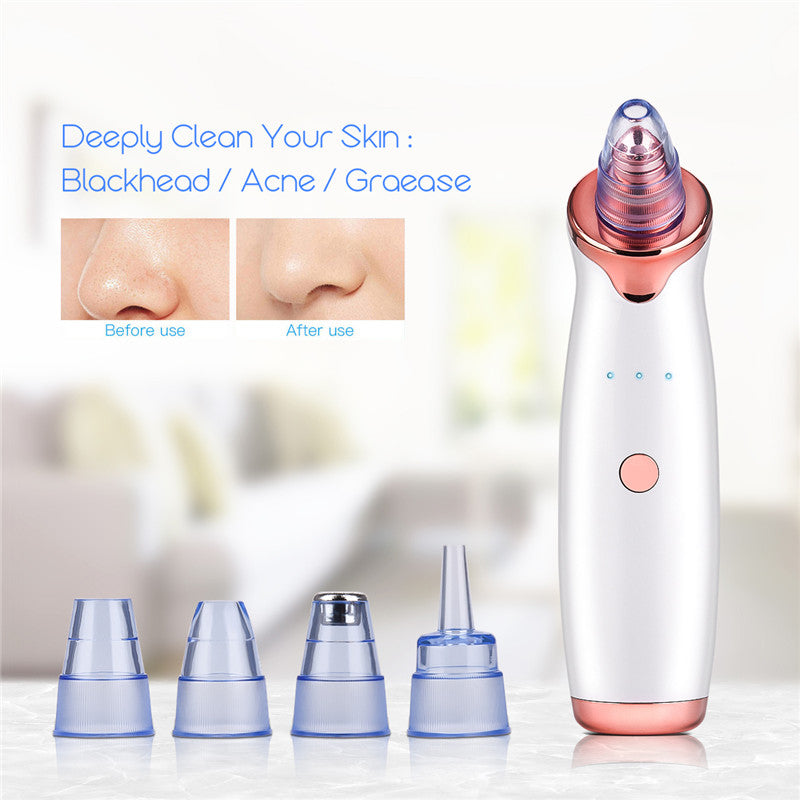 Electric Blackhead Remover