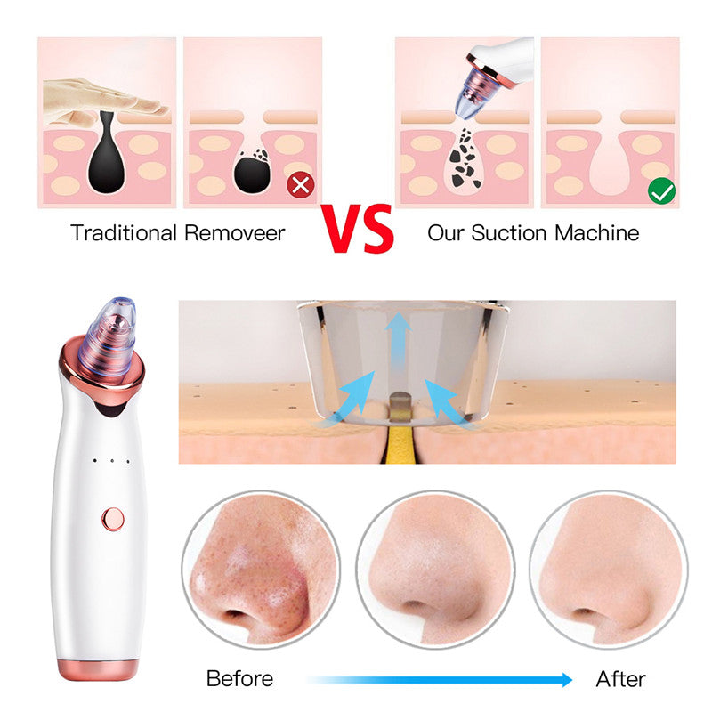 Electric Blackhead Remover