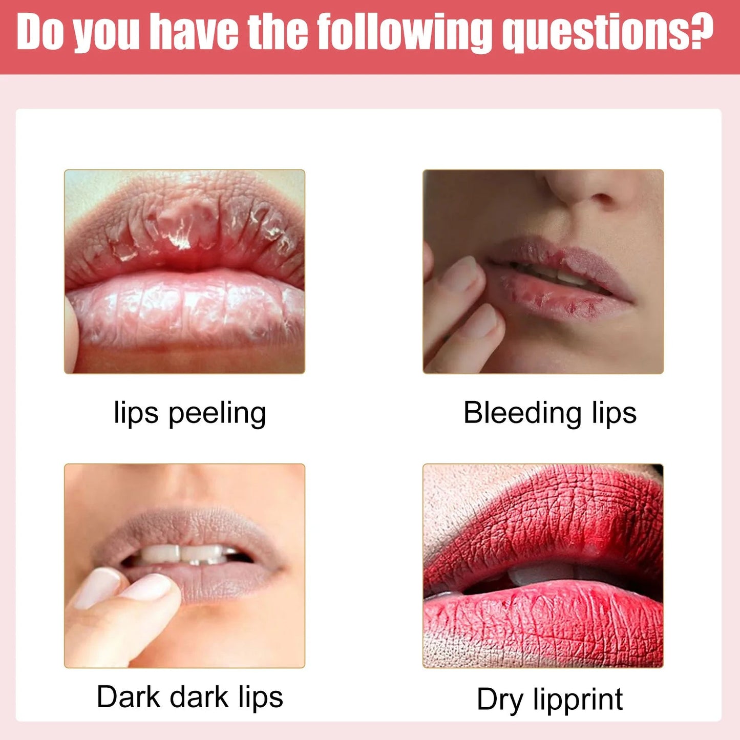 Lip Lightening Cream